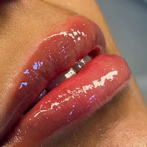 Lábios após o Hidra Gloss